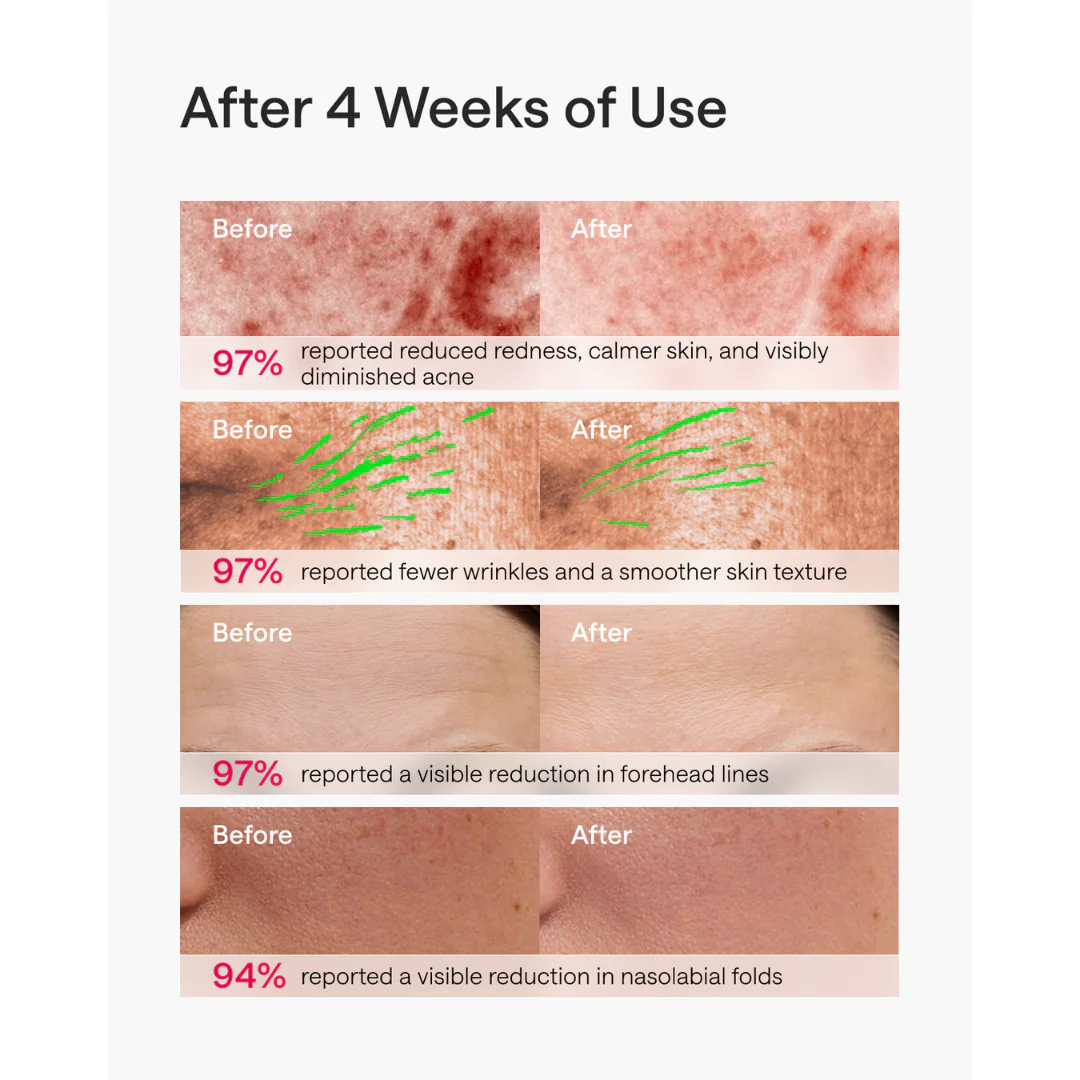 Ulike ReGlow Pro + 3 Ulike Aftercare Hydrating Mask sets - 15 sheet masks - Image 6