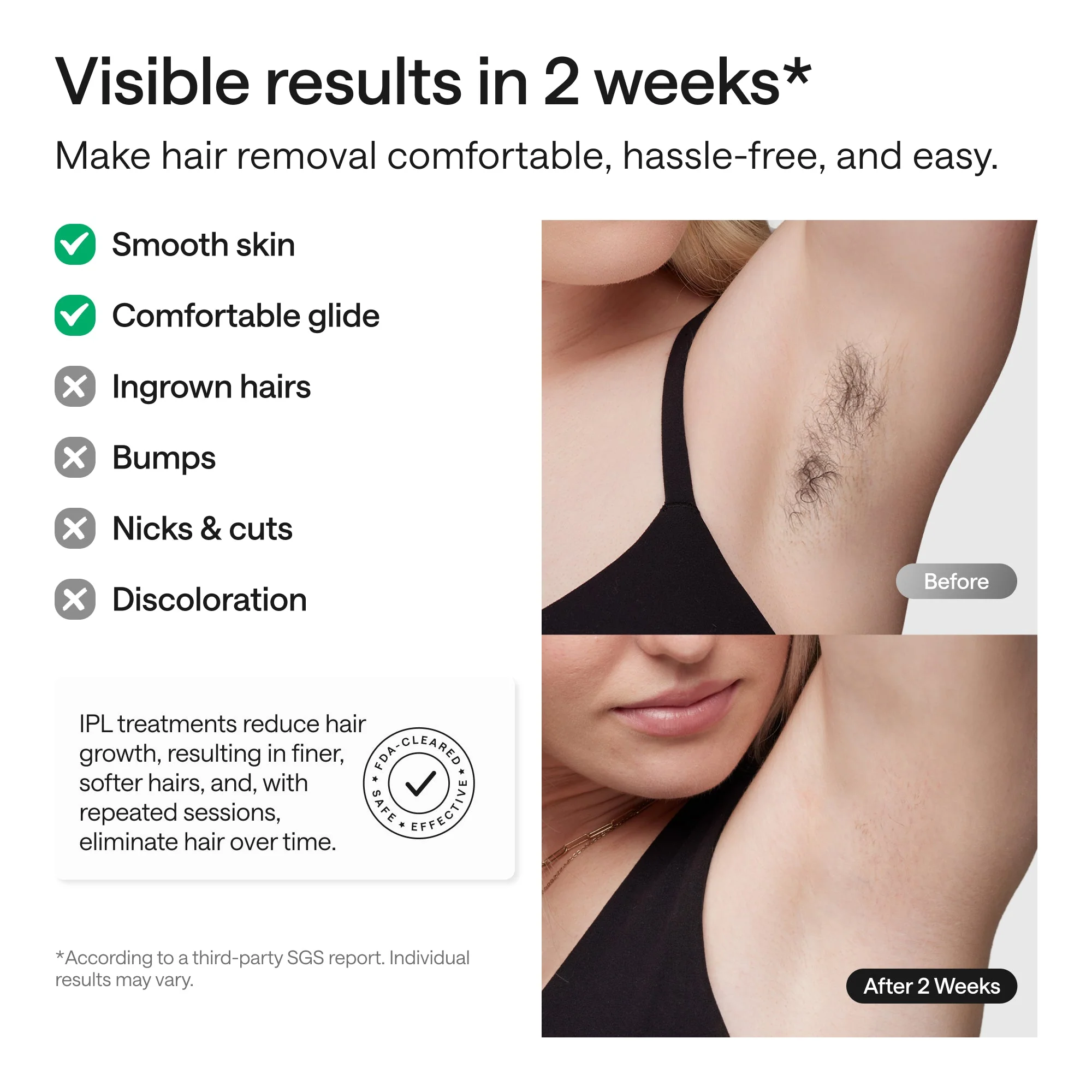 Ulike Swift 5 Hair Removal Device - Image 7